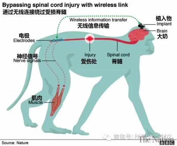 把WiFi装进大脑里，就可以治好瘫痪？瘫痪的猴子竟然6天正常走路